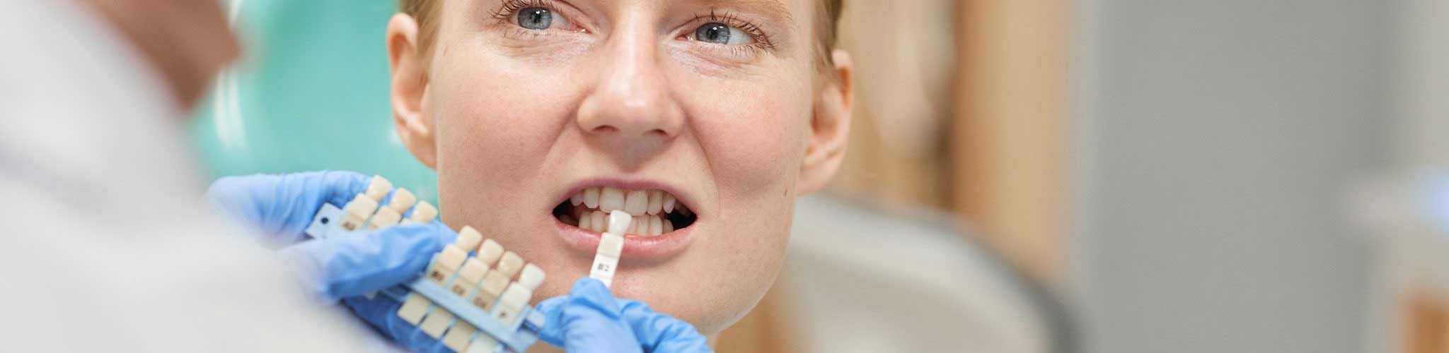 Best Teeth Whitening in Dubai | Laser & Professional Whitening