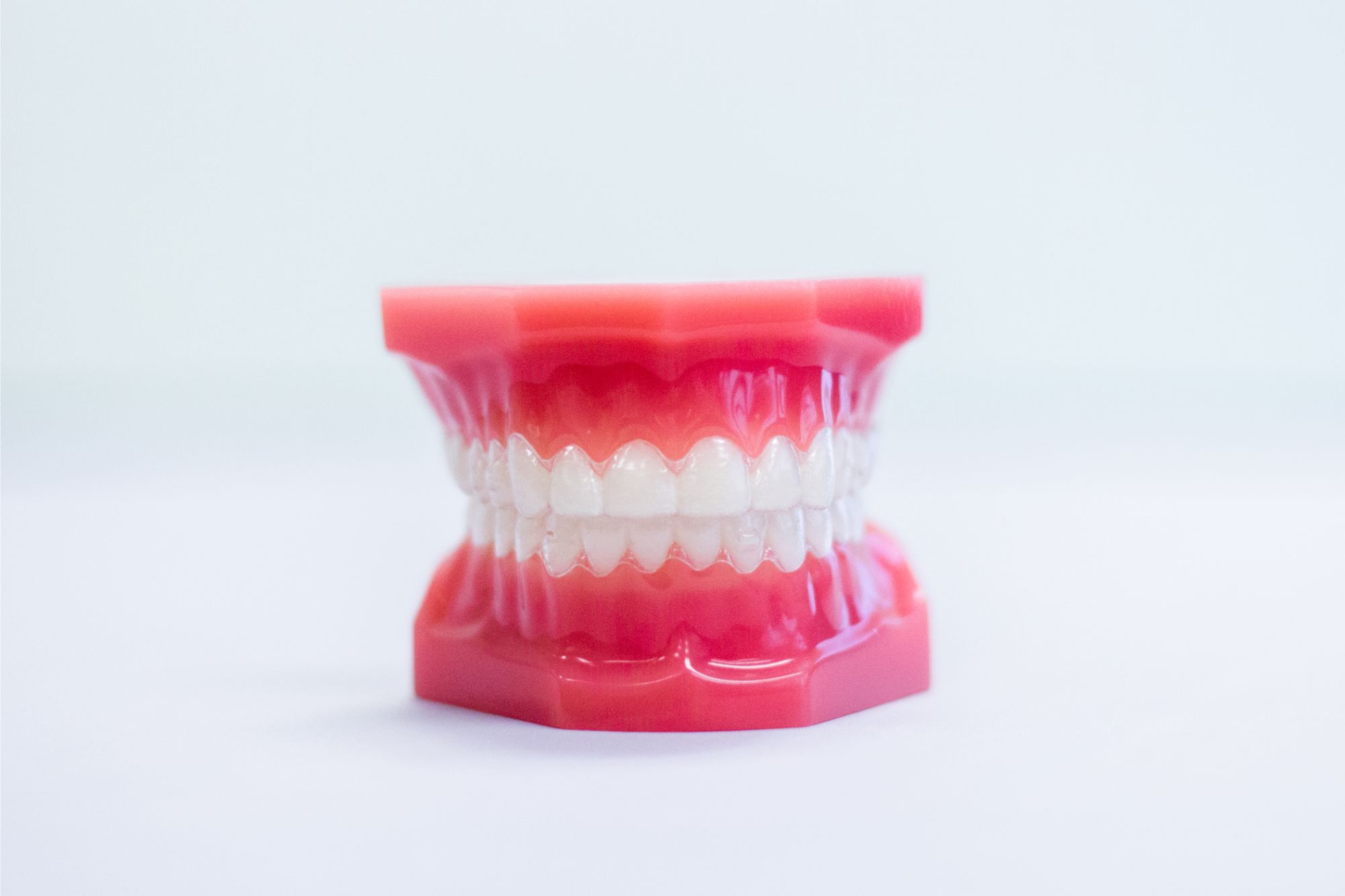 Clear Aligners - Ossi Orthodontics - Jacksonville Clear Aligners